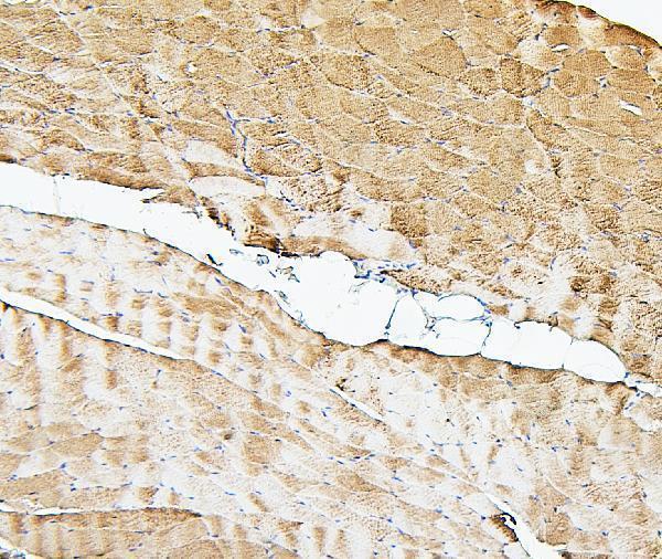 M04773 Cofilin 2 primary antibodies IHC testing 4