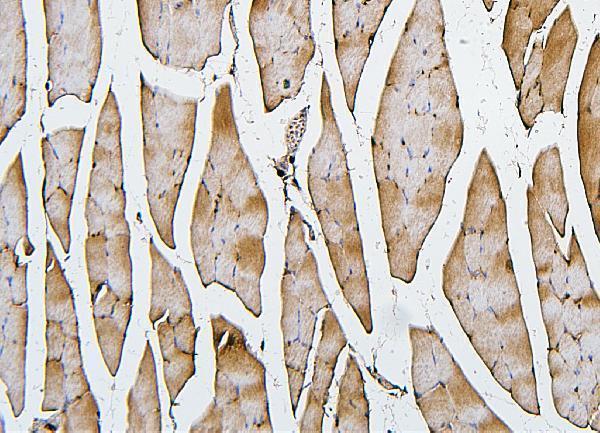 M04773 Cofilin 2 primary antibodies IHC testing 5