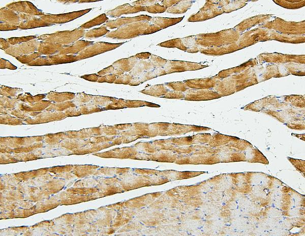 M04773 Cofilin 2 primary antibodies IHC testing 6