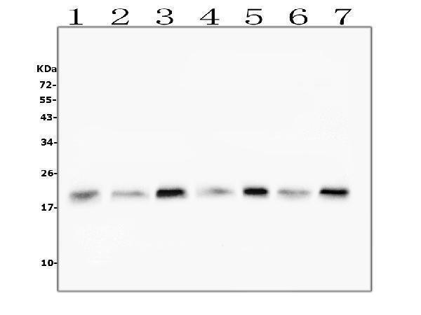  Western blot analysis of Cofilin-2 using anti-Cofilin-2 antibody (M04773)