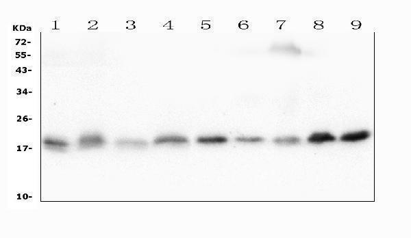  Western blot analysis of Cofilin-2 using anti-Cofilin-2 antibody (M04773)