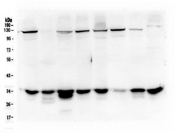 Western blot analysis of AMPK beta 2 using anti-AMPK beta 2 antibody (M05077). Electrophoresis was performed on a 10% SDS-PAGE gel at 70V (Stacking gel) / 90V (Resolving gel) for 2-3 hours. The sample well of each lane was loaded with 50ug of sample under reducing conditions. Lane 1: human Hela whole cell lysate, Lane 2: human placenta tissue lysate, Lane 3: human 293T whole cell lysate, Lane 4: human A549 whole cell lysate, Lane 5: human A375 whole cell lysate, Lane 6: human A431 whole cell lysate, Lane 7: human U20S whole cell lysate, Lane 8: human K562 whole cell lysate. After Electrophoresis, proteins were transferred to a Nitrocellulose membrane at 150mA for 50-90 minutes. Blocked the membrane with 5% Non-fat Milk/ TBS for 1.5 hour at RT. The membrane was incubated with mouse anti-AMPK beta 2 antigen affinity purified monoclonal antibody (Catalog # M05077) at 0.5 μg/mL overnight at 4°C, then washed with TBS-0.1%Tween 3 times with 5 minutes each and probed with a goat anti-mouse IgG-HRP secondary antibody at a dilution of 1:10000 for 1.5 hour at RT. The signal is developed using an Enhanced Chemiluminescent detection (ECL) kit (Catalog # EK1001) with Tanon 5200 system.