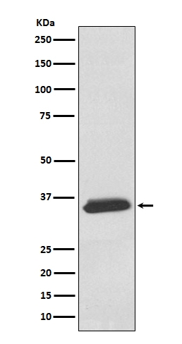 Western blot analysis of delta Sarcoglycan expression in Human fetal heart lysate