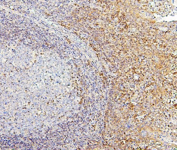  IHC analysis of PPCS using anti-PPCS antibody (M05567)