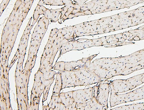 M05567 PPCS primary antibodies IHC testing 4