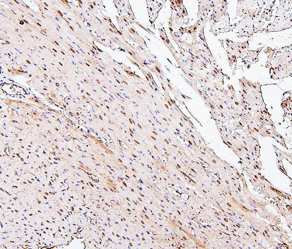 M05567 PPCS primary antibodies IHC testing 5