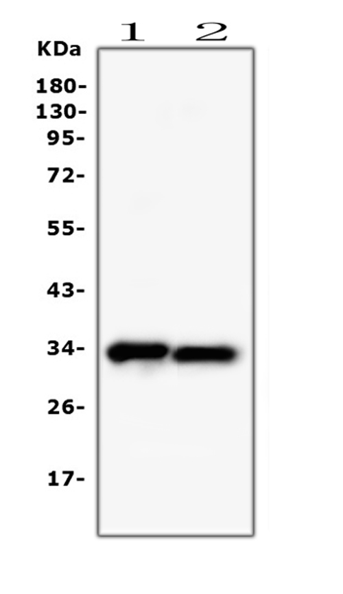  Western blot analysis of PPCS using anti-PPCS antibody (M05567)
