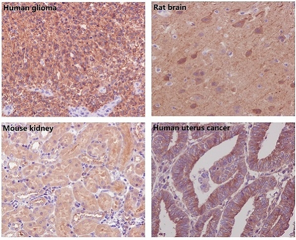 Immunohistochemical analysis of paraffin-embedded (1) Human glioma; (2) Rat brain; (3) Mouse kidney; (4) Human uterus cancer, using beta Tubulin Antibody