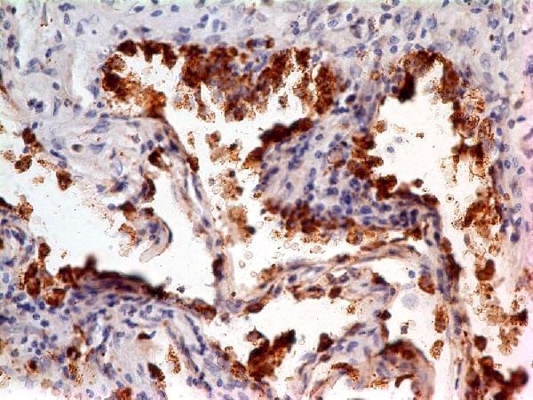 M05685 Immunostaining Analysis 2