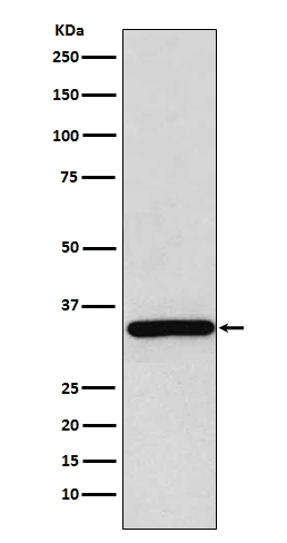 Western blot analysis of gamma Sarcoglycan expression in Human skeletal muscle lysate
