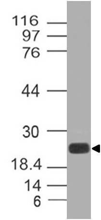 Western blot analysis of CLEC4E. Anti-CLEC4E antibody (Clone: ABM42C6) was tested at 2 &mu