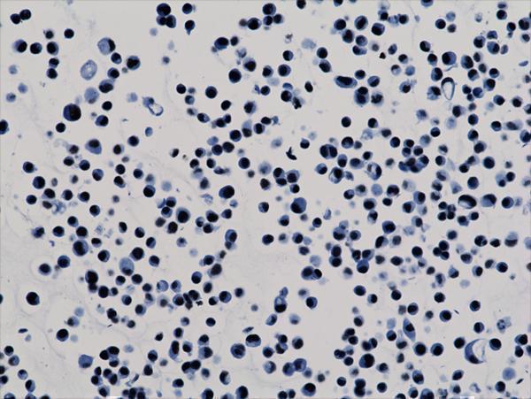 M06819 11 IHC test result image 3