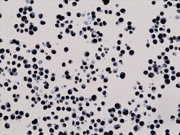 M06819 18 IHC test result image 3