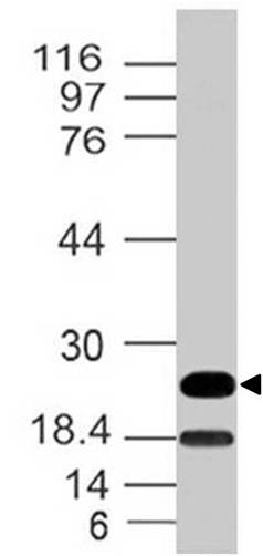 Westernblot analysis of hEBI3