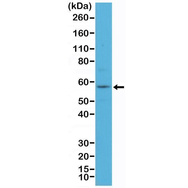  Western Blotting resultWestern Blot of A431 cell lysate using anti-CK-4 rabbit monoclonal antibody (Clone RM355) at a 1:100 dilution