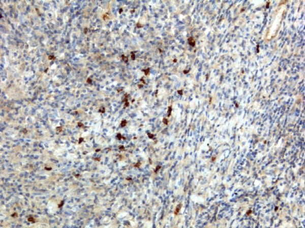  IHC resultImmunohistochemistry of human lymphoid tissue using anti-human IgA antibody RM128