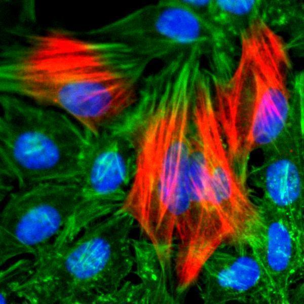  ICC resultImmunocytochemistry of HeLa cells, using Calponin-1 Rabbit Monoclonal Antibody (Clone RM262) (red)