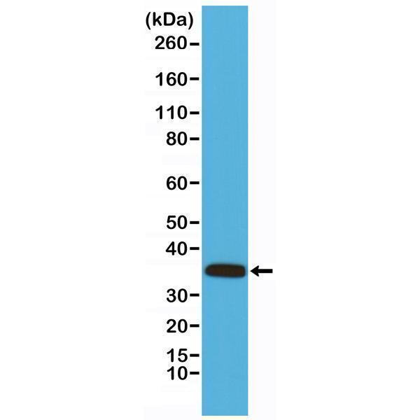  Western Blotting resultWestern Blot analysis of mouse heart tissue lysates, using anti-Calponin-1 rabbit monoclonal antibody (Clone RM262), shows Calponin-1 expression in mouse heart tissue