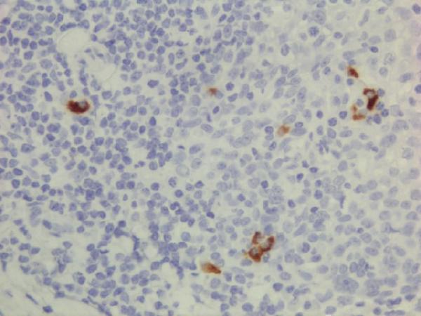 M08374 1 IHC test result image 6