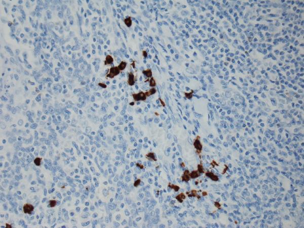 M08374 1 IHC test result image 7