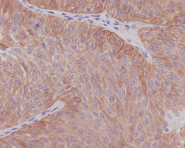 Immunohistochemical analysis of paraffin-embedded human bladder, using alpha Tubulin Antibody
