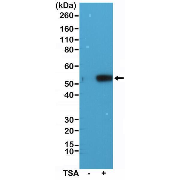  Western Blotting resultWestern Blot analysis of HeLa cell lysates non-treated (-) or treated (+) with Trichostatin A (TSA), using anti-Acetyl-alpha-Tubulin (Lys40) rabbit monoclonal antibody (Clone RM318) at a 1:1000 dilution