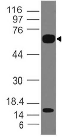 Western blot analysis of IL-36R
