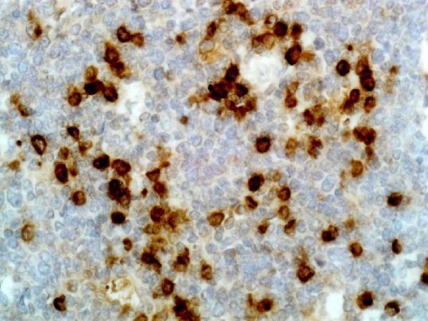  IHC resultImmunohistochemical staining of formalin fixed and paraffin embedded human tonsil tissue section using anti-human Ig lambda light chain rabbit monoclonal antibody (Clone RM127)