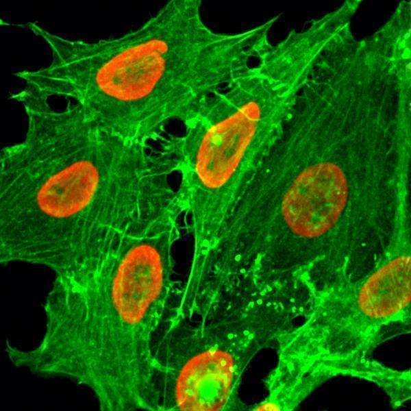  ICC resultImmunocytochemical staining of HeLa cells treated with sodium butyrate, using anti-Acetyl-Histone H2B (Lys20) Rabbit Monoclonal Antibody (Clone RM235) (red)