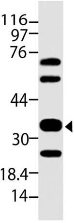 M30285 Western Blotting Analysis 1