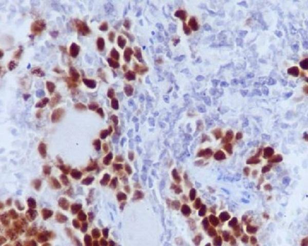 P00039 1 RB1 primary antibodies IHC testing 1