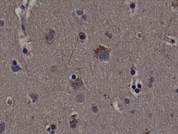  IHC resultImmunohistochemical staining of formalin fixed and paraffin embedded human cerebral cortex tissue sections using Anti-phospho-Rsk1 (Thr359/Ser363) RM233 at a 1:200 dilution