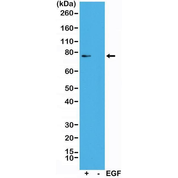  Western Blotting resultWestern Blot of A431 cells treated (+) or nontreated (-) with EGF, using Anti-phospho-Rsk1 (Thr359/Ser363) RM233 at a 1:1000 dilution, showed a band of phosphorylated Rsk1 only in EGF treated A431 cells 