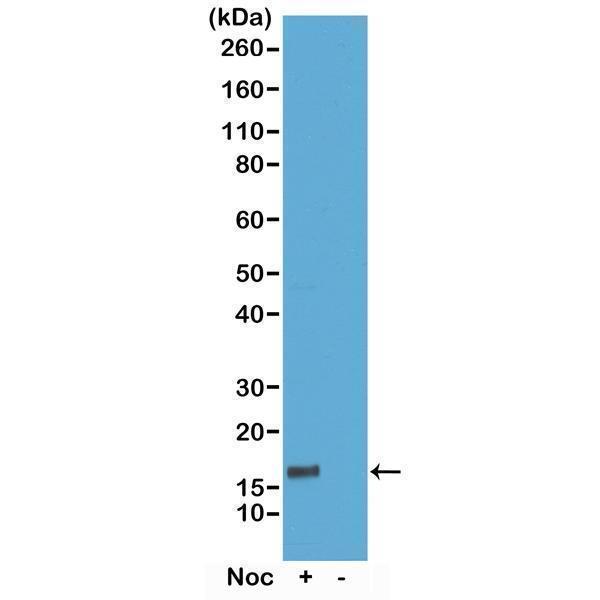 P06819 2 WB test result image 1