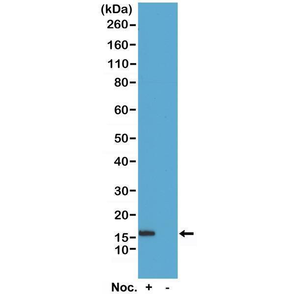 P12718 1 WB test result image 1