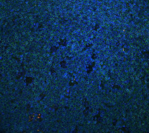IF analysis of CD45 using anti-CD45 antibody (PB9096-Dyl488) CD45 was detected in paraffin-embedded section of human tonsil tissues. Heat mediated antigen retrieval was performed in citrate buffer (pH6, epitope retrieval solution ) for 20 mins. The tissue section was blocked with 10% goat serum. The tissue section was then incubated with 1μg/mL rabbit anti-CD45 Antibody (PB9096-Dyl488) overnight at 4°C. DyLight488 Conjugated Goat Anti-Rabbit IgG (BA1127) was used as secondary antibody at 1:100 dilution and incubated for 30 minutes at 37°C. The section was counterstained with DAPI. Visualize using a fluorescence microscope and filter sets appropriate for the label used.