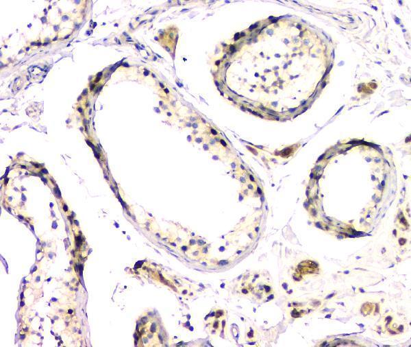 RP1083 DMRT1 primary antibodies IHC testing 4