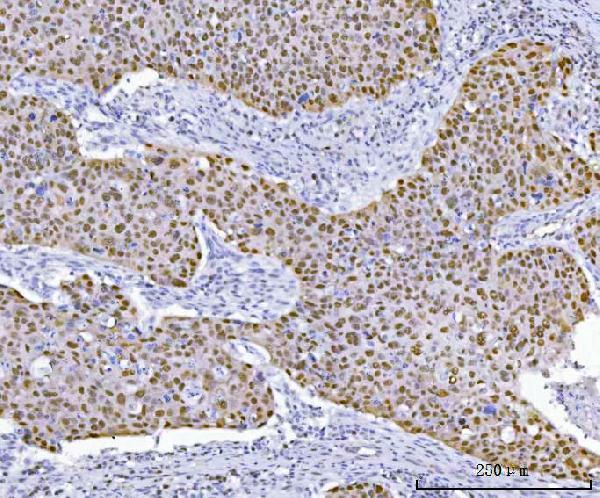 a00001 2 tp53 primary antibodies ihc testing 2