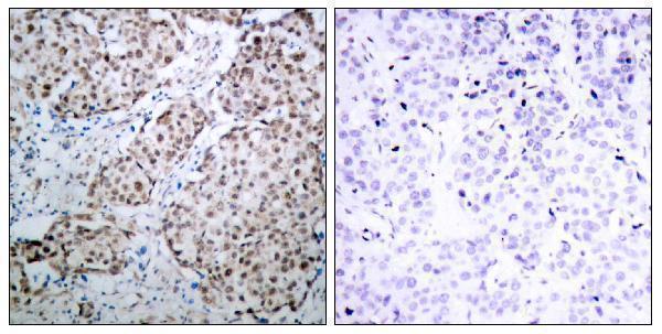 a00001s315 1 tp53 primary antibodies ihc testing 1