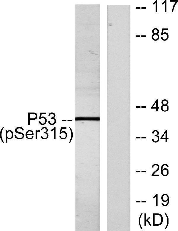 a00001s315 1 tp53 primary antibodies wb testing 3