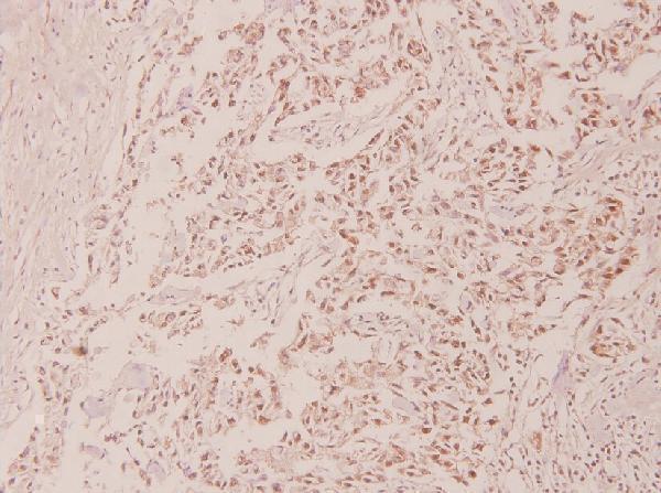 a00001s315 tp53 primary antiboties ihc testing 2