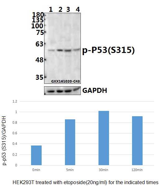 a00001s315 tp53 primary antiboties wb testing 3