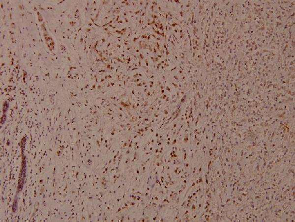 a00001s37 tp53 primary antiboties ihc testing 2