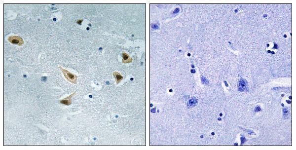 a00001s376 1 tp53 primary antibodies ihc testing 2
