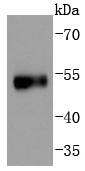 a00001s376 tp53 primary antiboties wb testing 1