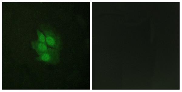 a00001s392 tp53 primary antibodies if testing 4