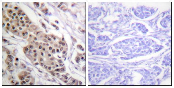 a00001s392 tp53 primary antibodies ihc testing 3
