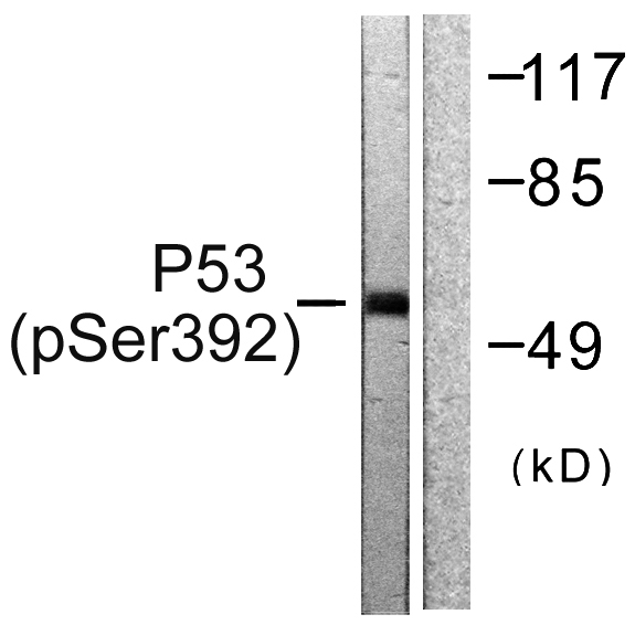 a00001s392 tp53 primary antibodies wb testing 2