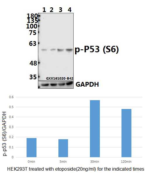a00001s6 1 tp53 primary antiboties wb testing 1