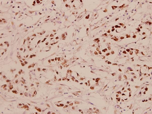 a00001s9 1 tp53 primary antiboties ihc testing 2